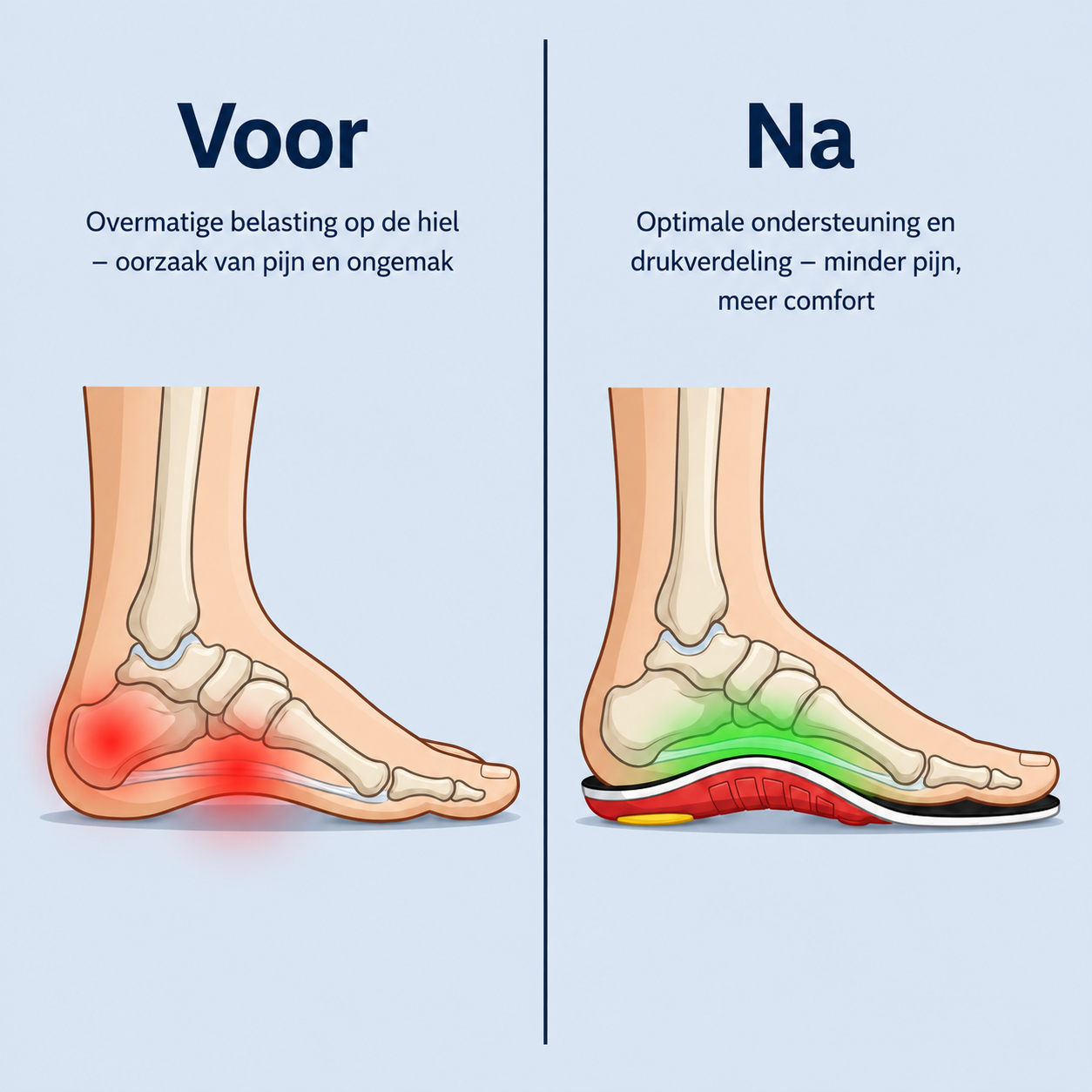 Archi Steps | Inlegzolen met Voetboogondersteuning